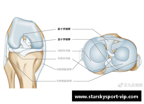 球员前交叉韧带损伤：预防与康复指南